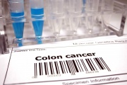 A study co-authored by an MIT economist shows that screening for colon cancer reduces cancer rates by substantially more than previously published analyses of randomized trials suggest.